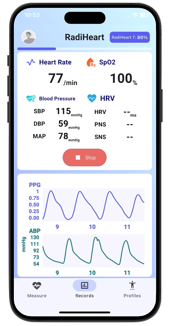 RadiHeart measurement and analysis screen