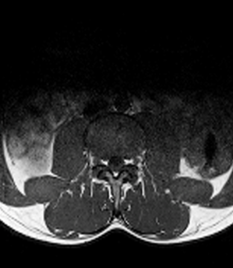 Original axial lumbar MRI image before analysis