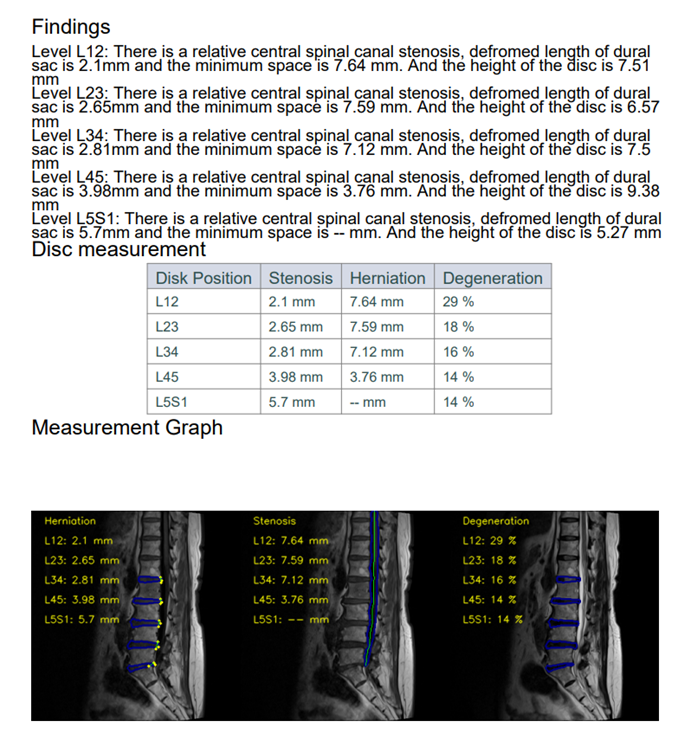 RadiSpine sample report, including findings, a disc measurement table and measurement images